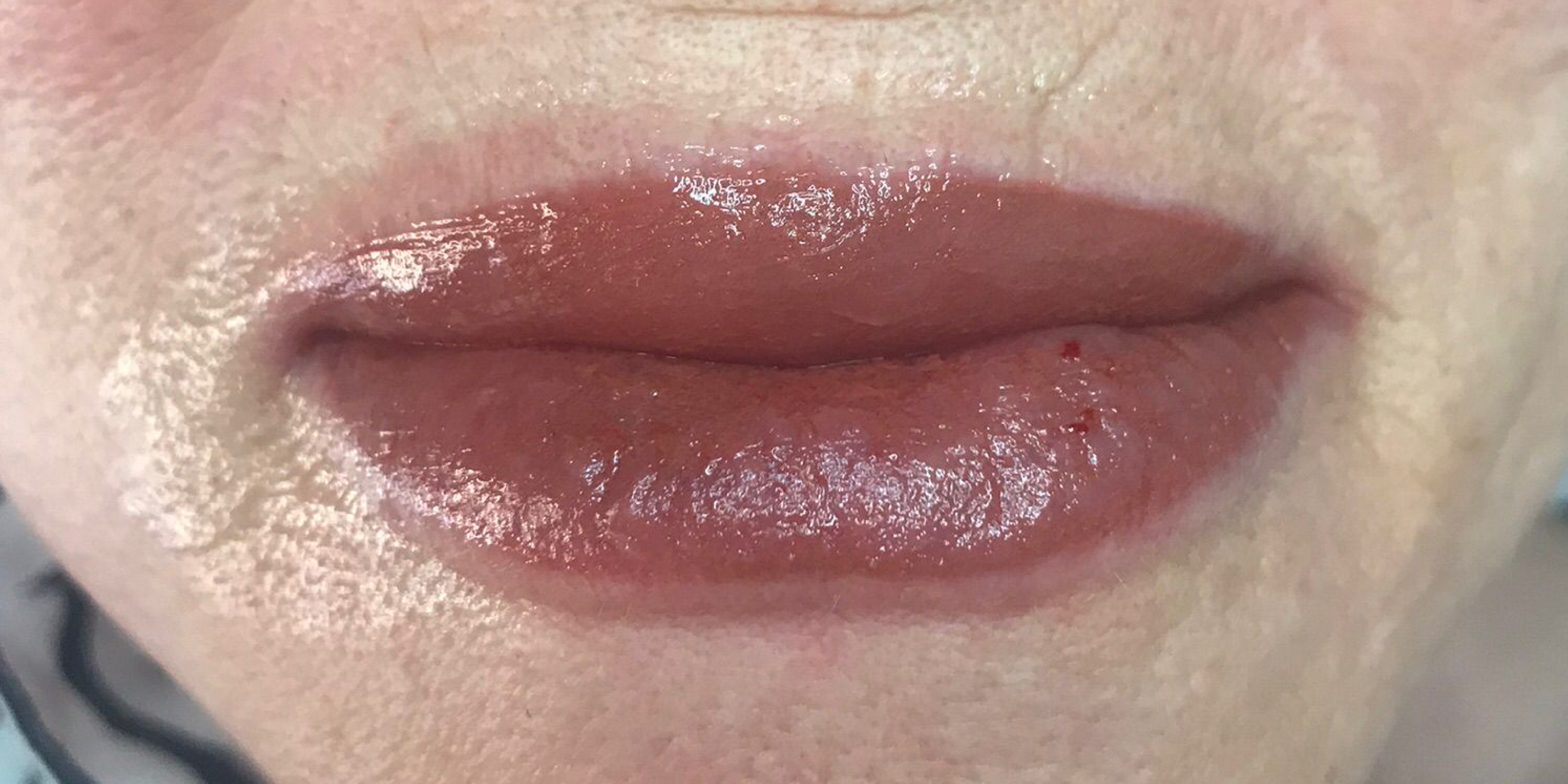 Lalin Beauty Dudak Renklendirme Sonucu 2