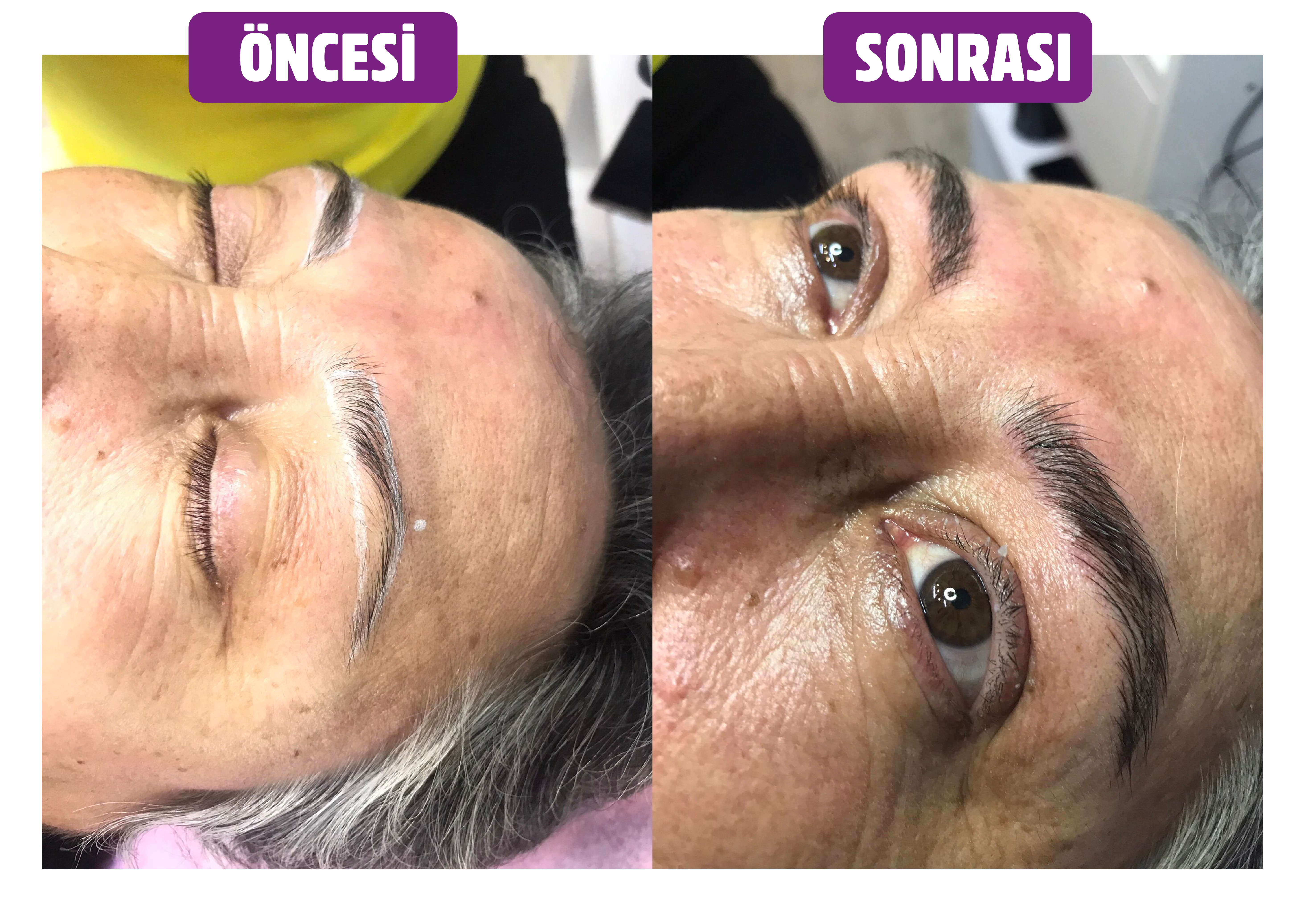 Lalin Beauty Microblading Sonucu